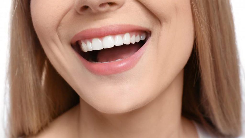 Veneers before and after results - North Sydney Dental Practice