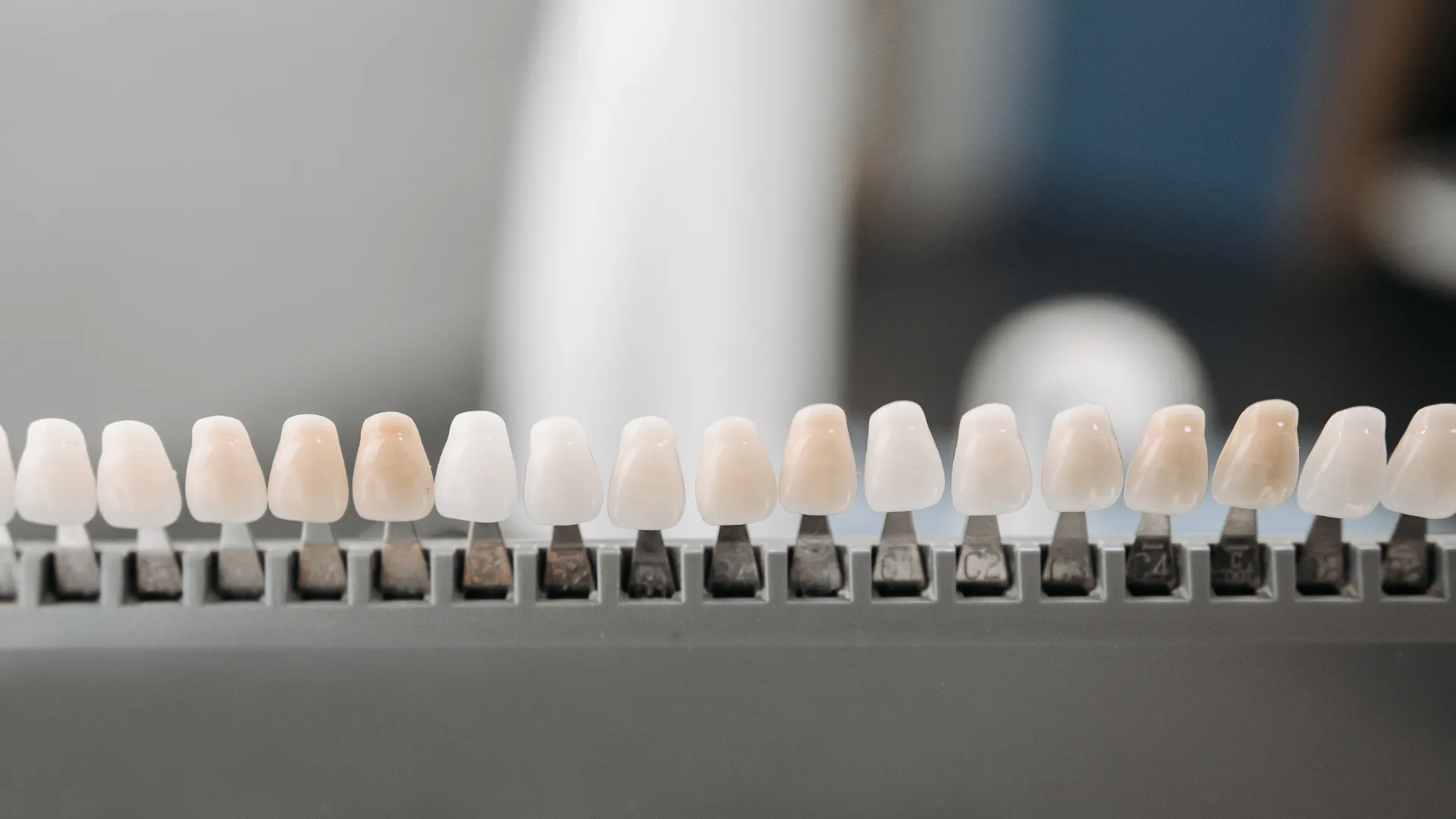 Veneers: The comprehensive guide of benefits and considerations