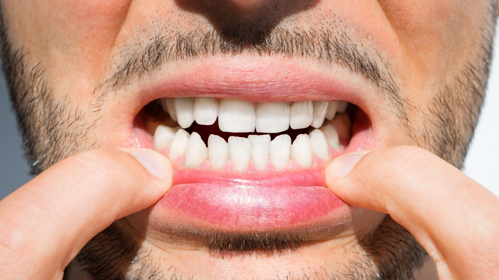 Want to fix your smile now? 5 ways we can help
